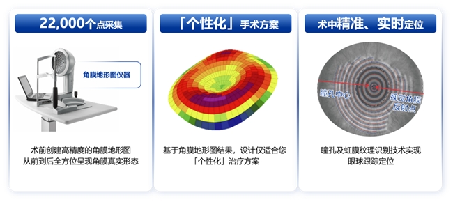 鄭州普瑞丨量眼定制獨一無二的清晰，個性化近視手術，為您提供極致的視覺體驗！(圖3)