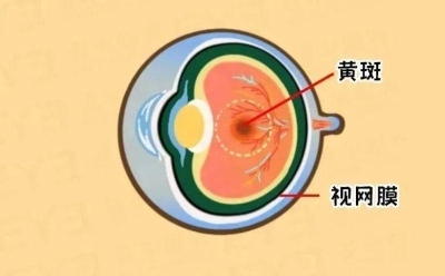 愛爾眼科：激光“打”在眼內還能治眼病？(圖3)